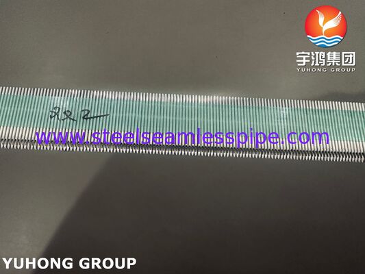 হাই-পারফরম্যান্স এসইউএস৩০৪ মেডিকেল স্টেইনলেস স্টিল এভিএফ ক্যানুল হিমোডায়ালাইসিসের জন্য ১৫জি-১৭জি গেজ রেঞ্জ এবং মাইক্রো পোলিশ পৃষ্ঠের সাথে